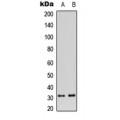 LifeSab™ CD159a Rabbit pAb (50 µl)