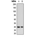 LifeSab™ MCL1 (pS159) Rabbit pAb (50 µl)