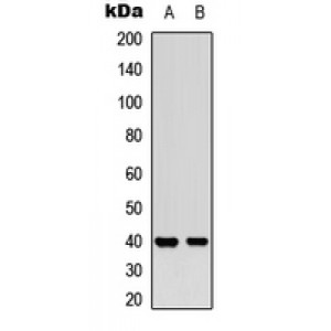 LifeSab™ MCL1 (pS159) Rabbit pAb (50 µl)