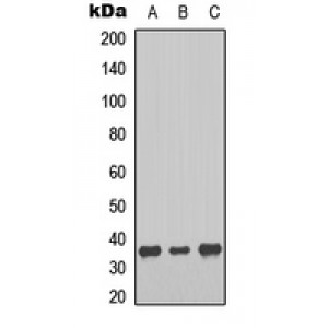 LifeSab™ Melatonin Receptor 1b Rabbit pAb (50 µl)