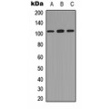 LifeSab™ NF-kappaB p105 (pS893) Rabbit pAb (50 µl)