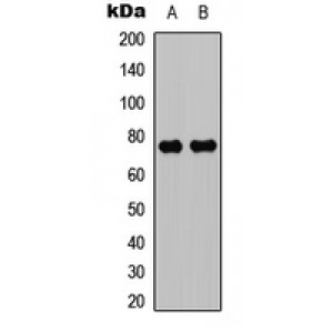 LifeSab™ PKC theta Rabbit pAb (50 µl)