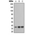 LifeSab™ RAD51D Rabbit pAb (50 µl)