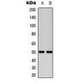 LifeSab™ Secretin Receptor Rabbit pAb (50 µl)