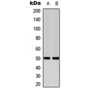 LifeSab™ Secretin Receptor Rabbit pAb (50 µl)