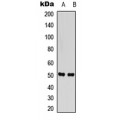 LifeSab™ SNAT2 Rabbit pAb (50 µl)