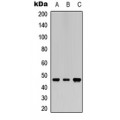 LifeSab™ Lupus La Rabbit pAb (50 µl)