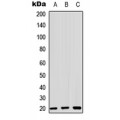 LifeSab™ ZNF695 Rabbit pAb (50 µl)