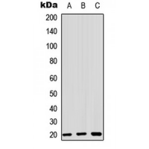 LifeSab™ ZNF695 Rabbit pAb (50 µl)