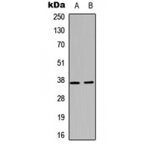 LifeSab™ CD1d Rabbit pAb (50 µl)