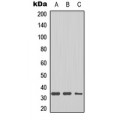 LifeSab™ DHRS4 Rabbit pAb (50 µl)