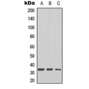 LifeSab™ DHRS4 Rabbit pAb (50 µl)