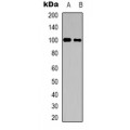 LifeSab™ CNTROB Rabbit pAb (50 µl)