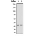 LifeSab™ PABPC5 Rabbit pAb (50 µl)