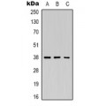 LifeSab™ Renin Rabbit pAb (50 µl)