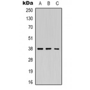 LifeSab™ Renin Rabbit pAb (50 µl)