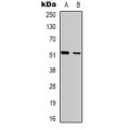 LifeSab™ SH2D2A Rabbit pAb (50 µl)