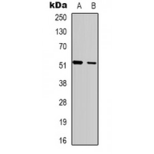 LifeSab™ SH2D2A Rabbit pAb (50 µl)