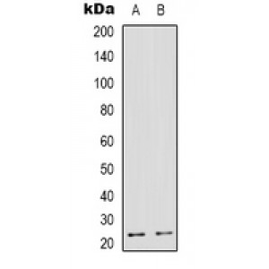 LifeSab™ TMBIM4 Rabbit pAb (50 µl)