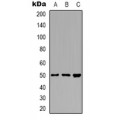 LifeSab™ ZFYVE19 Rabbit pAb (50 µl)