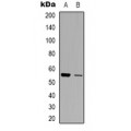 LifeSab™ ZNT1 Rabbit pAb (50 µl)