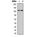 LifeSab™ Thrombospondin 4 Rabbit pAb (50 µl)