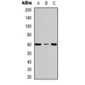 LifeSab™ gp91 phox Rabbit pAb (50 µl)