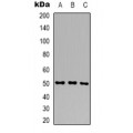 LifeSab™ ALT2 Rabbit pAb (50 µl)