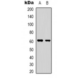 LifeSab™ YTHDF1 Rabbit pAb (50 µl)