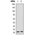 LifeSab™ ASF1B Rabbit pAb (50 µl)