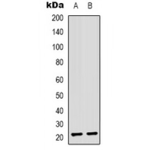 LifeSab™ ASF1B Rabbit pAb (50 µl)