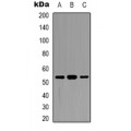 LifeSab™ DDX19B Rabbit pAb (50 µl)