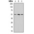 LifeSab™ RRP8 Rabbit pAb (50 µl)