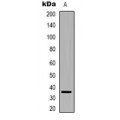 LifeSab™ PEX2 Rabbit pAb (50 µl)