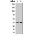 LifeSab™ TBL2 Rabbit pAb (50 µl)