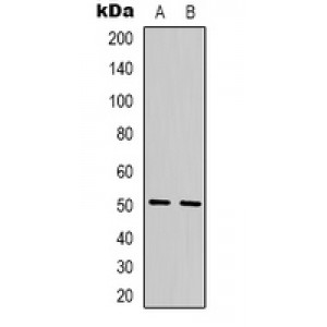 LifeSab™ TBL2 Rabbit pAb (50 µl)