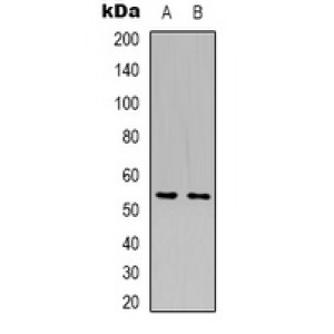 LifeSab™ GLUT5 Rabbit pAb (50 µl)