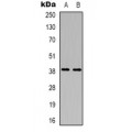 LifeSab™ CD84 Rabbit pAb (50 µl)