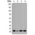 LifeSab™ NTPCR Rabbit pAb (50 µl)