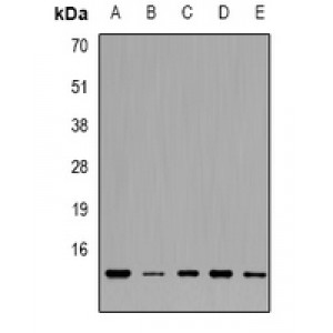 LifeSab™ TRP14 Rabbit pAb (50 µl)