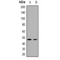 LifeSab™ IKK gamma Rabbit pAb (50 µl)