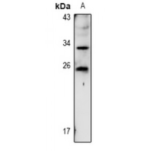 LifeSab™ TIG1 Rabbit pAb (50 µl)