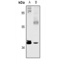 LifeSab™ SFXN4 Rabbit pAb (50 µl)