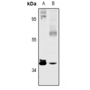 LifeSab™ SFXN4 Rabbit pAb (50 µl)