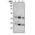 LifeSab™ LAT Rabbit pAb (50 µl)