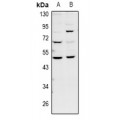 LifeSab™ GDF7 Rabbit pAb (50 µl)