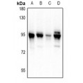 LifeSab™ PDXDC1 Rabbit pAb (50 µl)