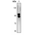 LifeSab™ OATP2 Rabbit pAb (50 µl)