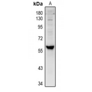 LifeSab™ Cytochrome P450 4V2 Rabbit pAb (50 µl)