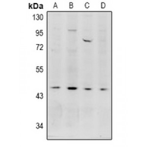 LifeSab™ Acrosin Rabbit pAb (50 µl)